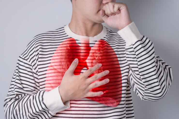Chest Diseases